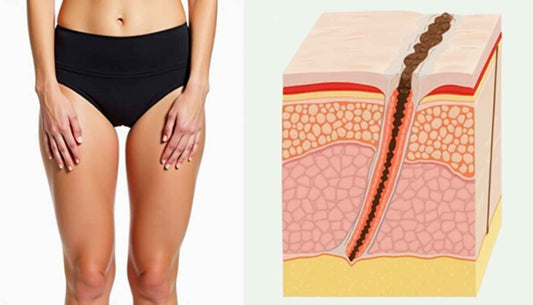 Deep Tissue Massage for Cellulite: Does It Really Work?