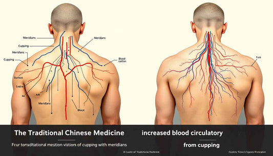 The Science Behind Cupping Therapy: Ancient Wisdom Meets Modern Proof